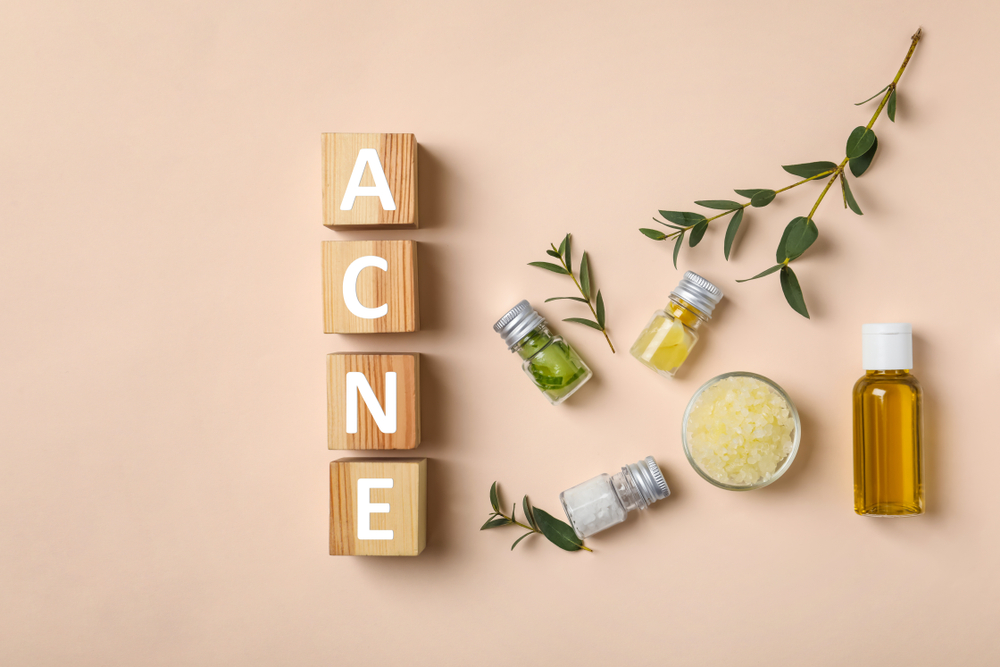 acne treatments salt lake city