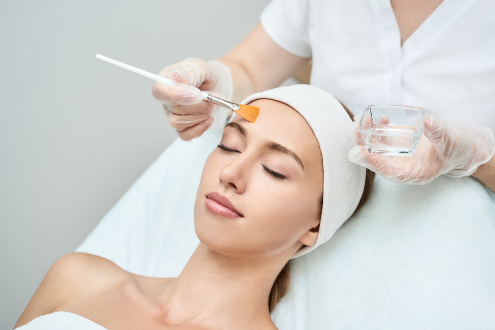 Chemical peels for acne