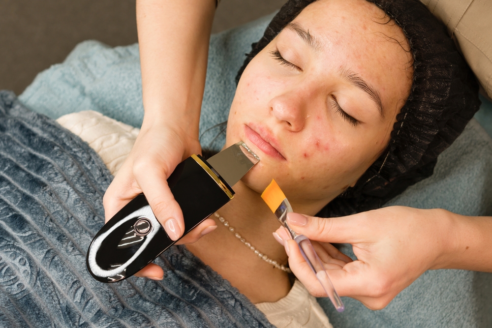 Acne treatment Salt Lake City